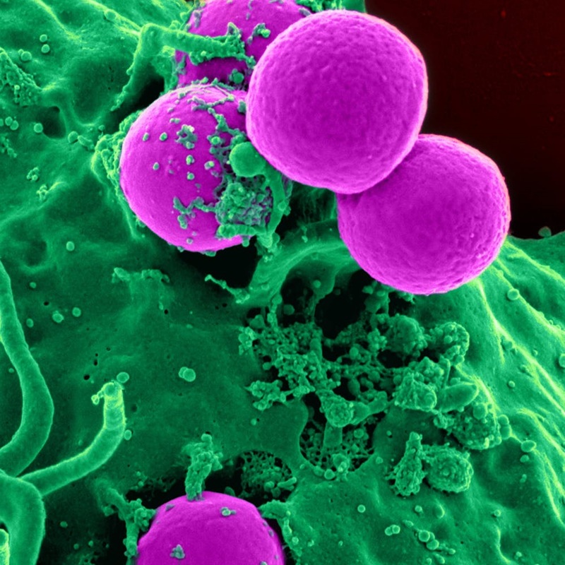 White blood cell cell blood cell blood 45239
